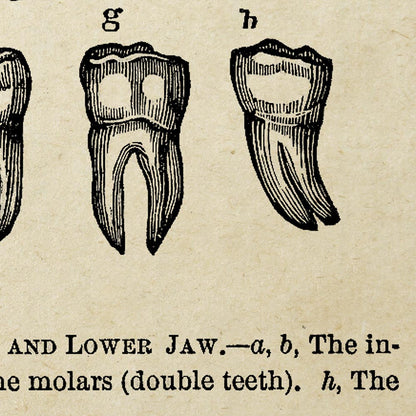 Conjunto de 2 láminas vintage de El dentista