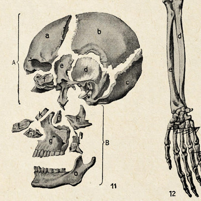 Pósteres de anatomía vintage "SKULL" Juego de 3 impresiones